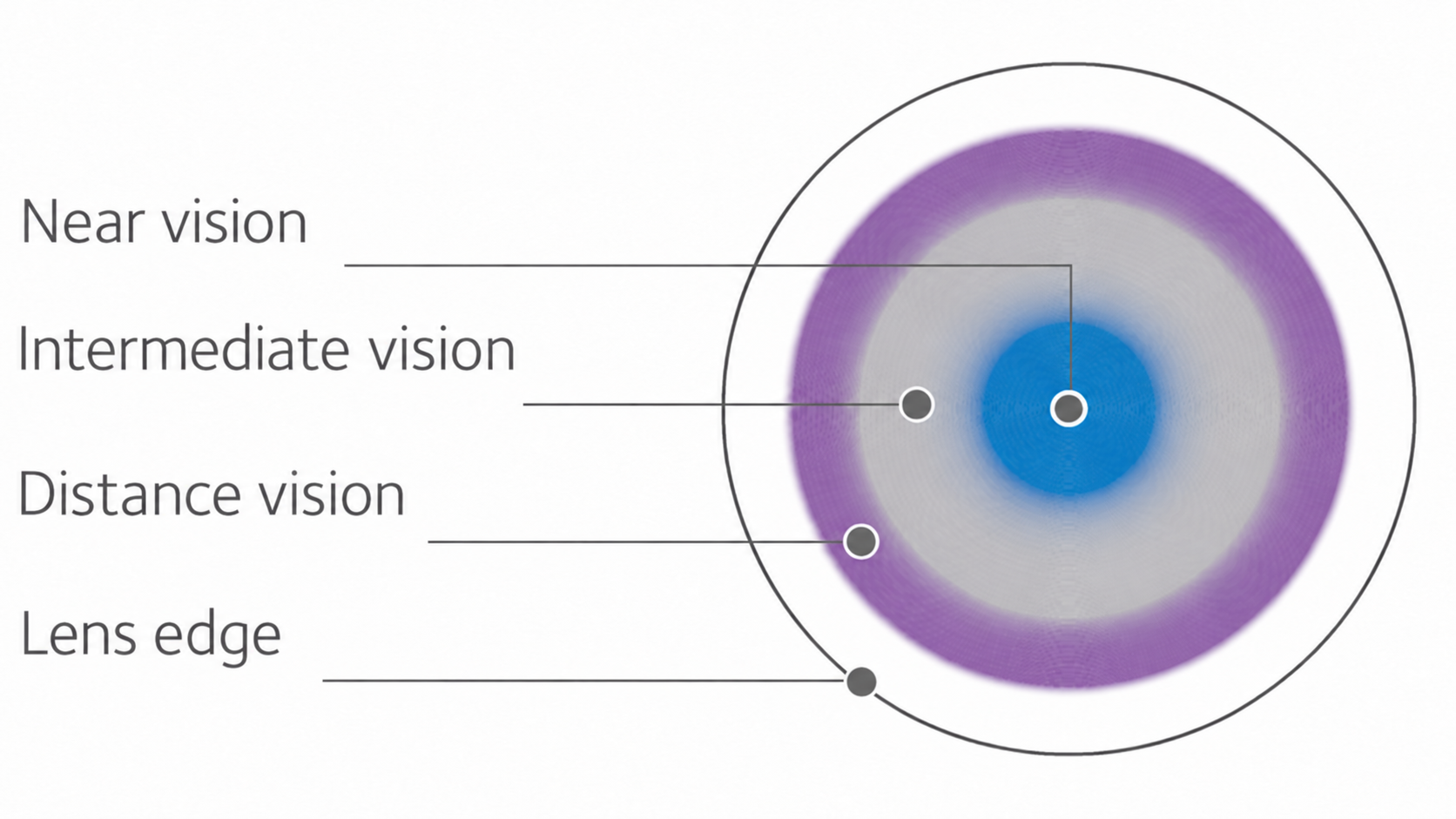N lens: near vision in the centre, intermediate and distance vision in the outer zones